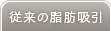 脂肪吸引