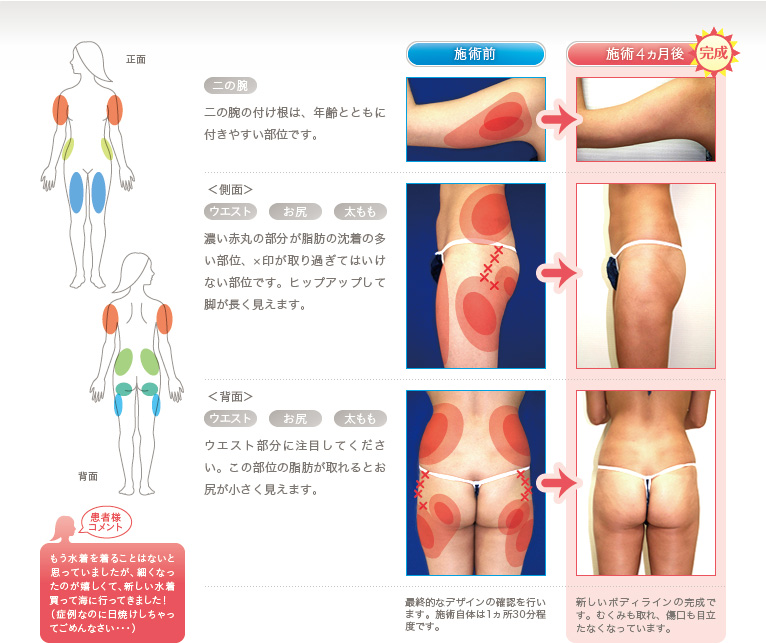 症例 詳細1
