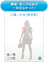 アンケート2
