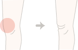脂肪を取り過ぎるとしわが寄ってしまうため、老けた脚に見られてしまいます
