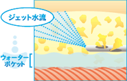 ボディジェットの施術