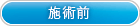 施術前