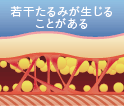 若干たるみが生じることがある