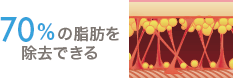70％の脂肪を除去できる