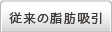従来の脂肪吸引